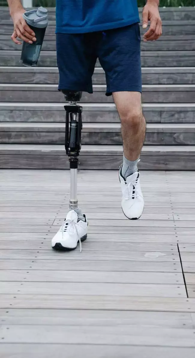 man with leg prosthesis shows strength